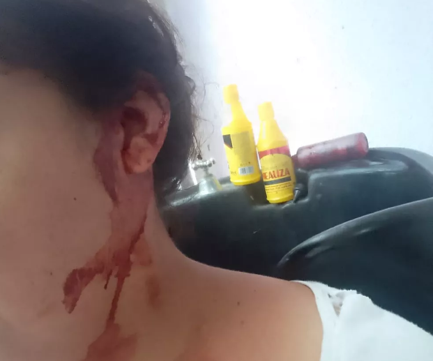 Mulher tem orelha mordida e leva pedradas na na cabeça após discussão sobre som alto no litoral de São Paulo