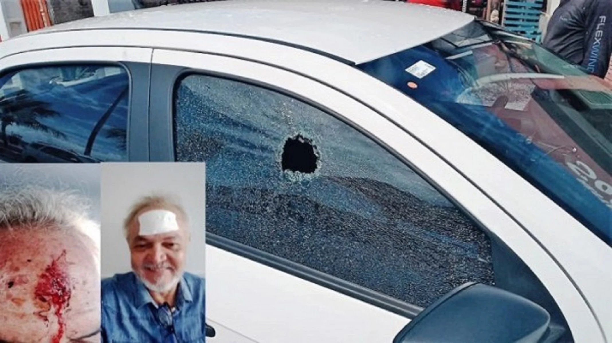 Secretário Adjunto de Articulação de Guamaré, Rosendo Ferreira sobrevive após levar tiro de raspão na cabeça em Taipu