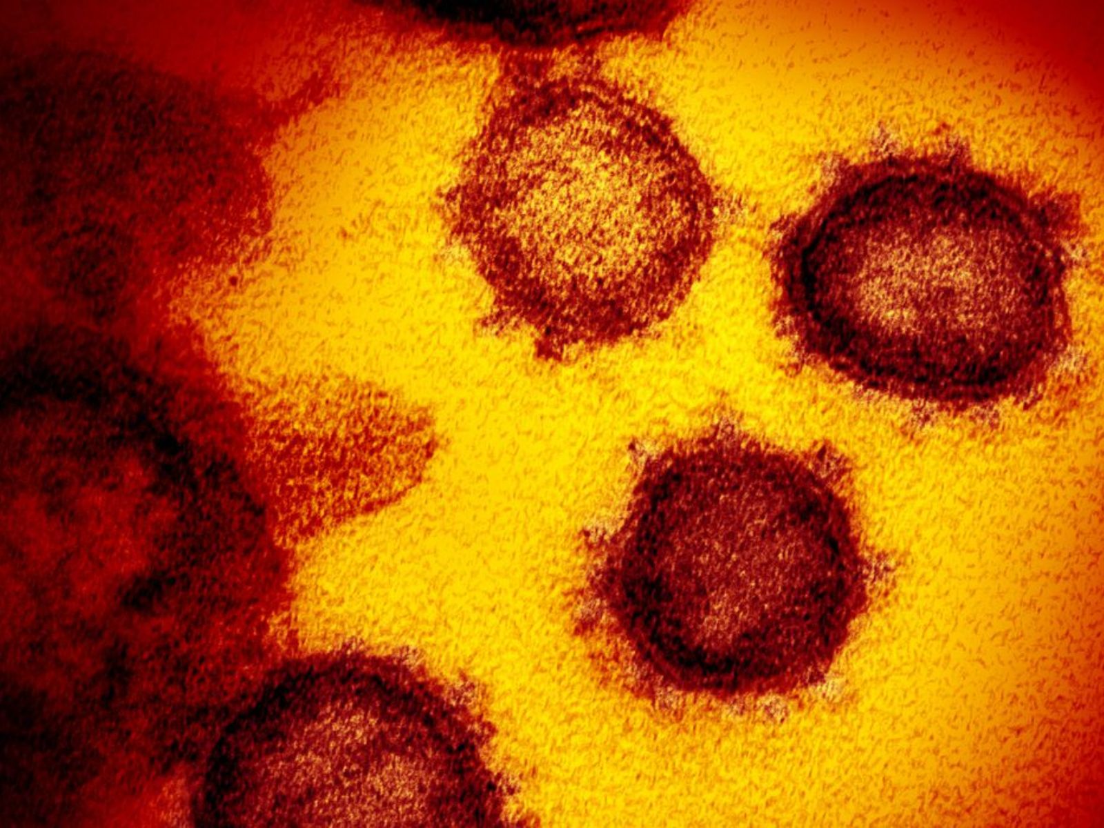 Pesquisa identifica duas novas linhagens do coronavírus no Brasil