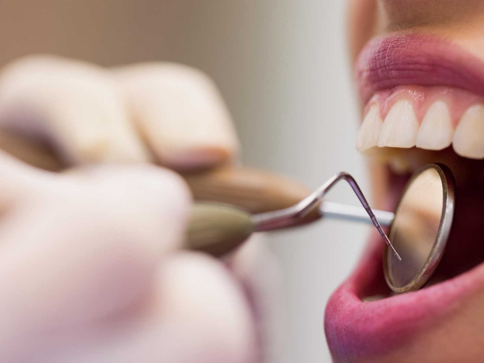 Adultos e crianças podem realizar triagem odontológica gratuita em Natal